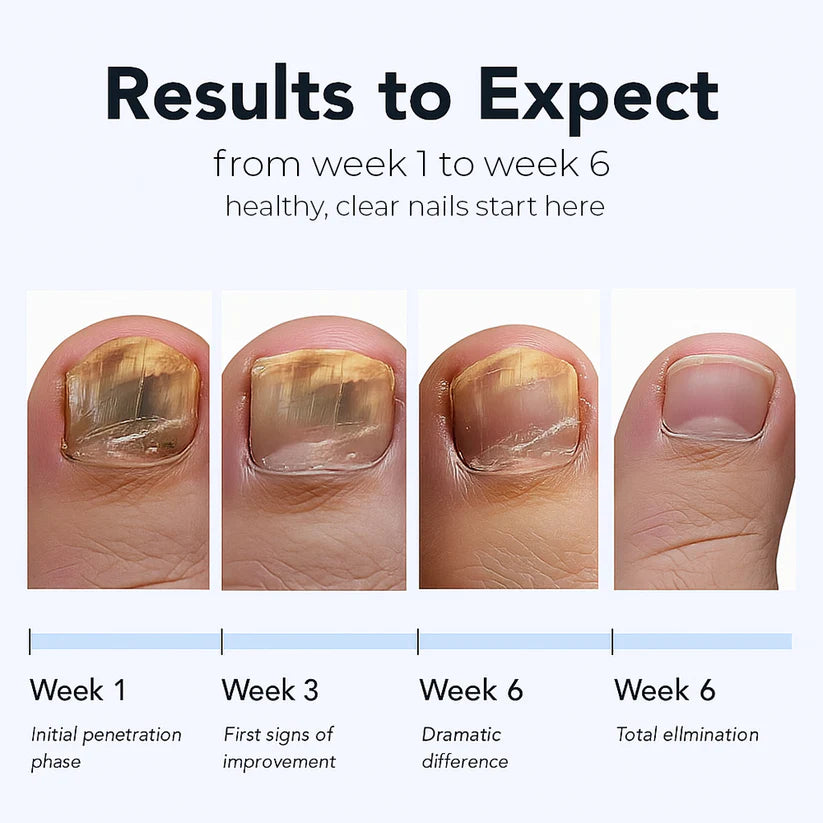 Lunvera™ Nail Repairs Patches