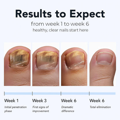 Lunvera™ Nail Repairs Patches